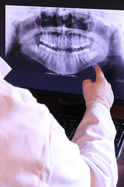 Best Mobile Emergency Dentist in Beverly Hills, CA