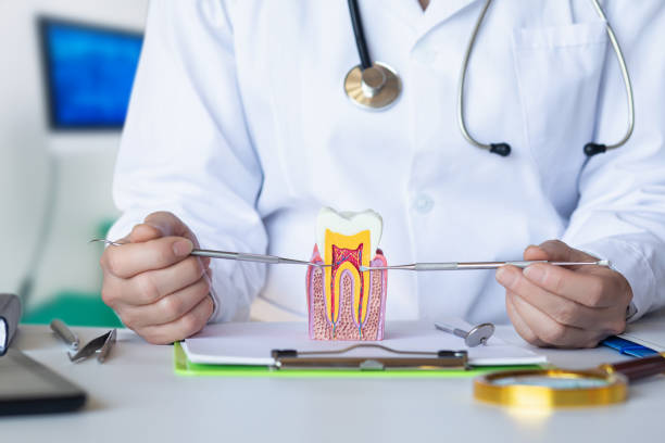 Best Emergency Dentist for Lost Fillings or Crowns in Beverly Hills, CA