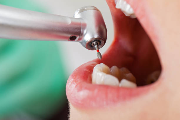 Best Emergency Cosmetic Dentistry in Beverly Hills, CA